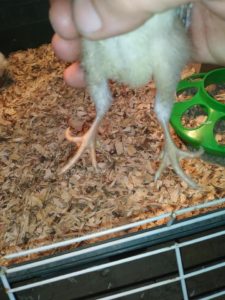 curled toe deformity